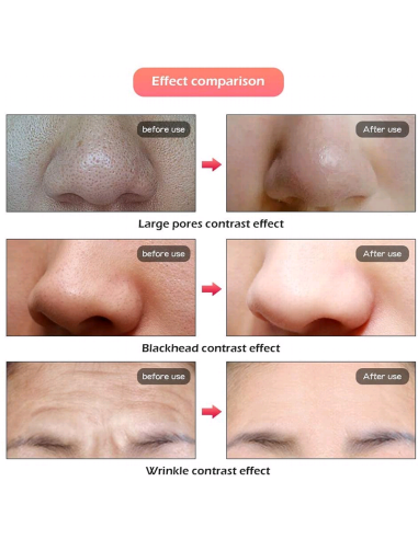 Mascara Terapia Con Luz Led Multiefecto Beauty Mask
