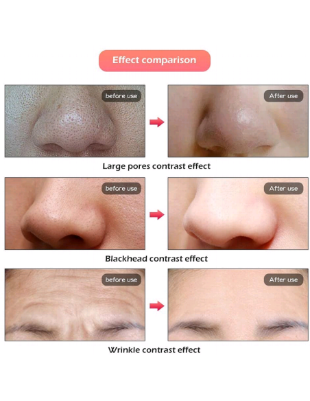 Mascara Terapia Con Luz Led Multiefecto Beauty Mask
