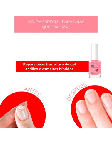 Tratamiento Uñas Frágiles Eveline Nail Therapy Sos 12Ml