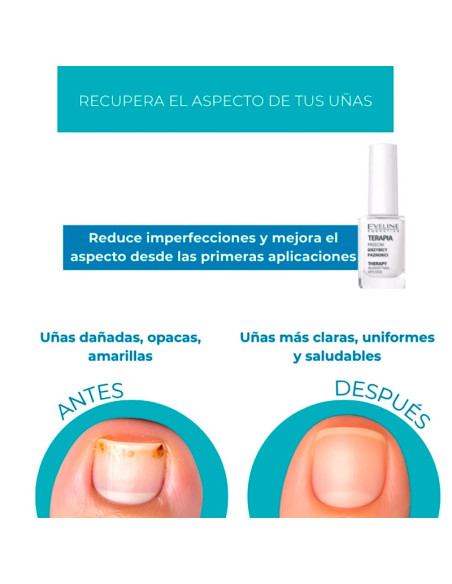 Tratamiento Uñas Antihongos Eveline Nail Therapy Micosis 12Ml